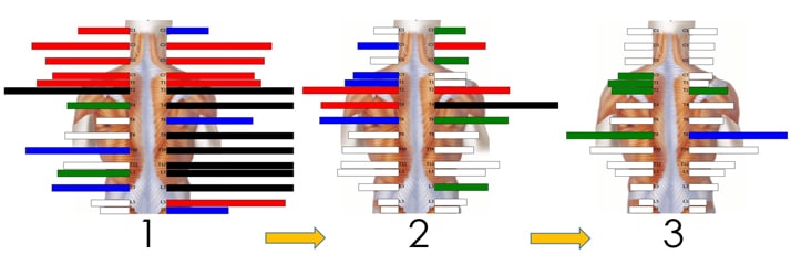 Chiropractic Princeton NJ Computerized Diagnostic Testing