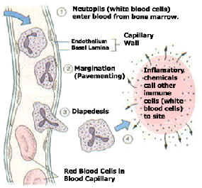 Chiropractic Princeton NJ Inflammation